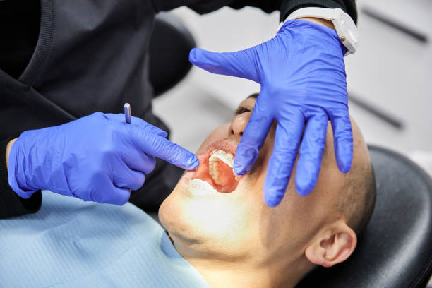 Best Emergency Dental Care for Abscessed Tooth in East Rockaway, NY